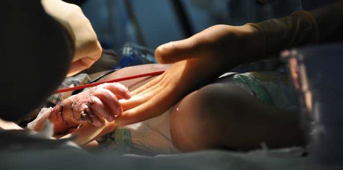 Ingatkan Dapur Tak Panas, Ibu Ini Tak Sengaja Letak Bayi Hingga Melecur Teruk!