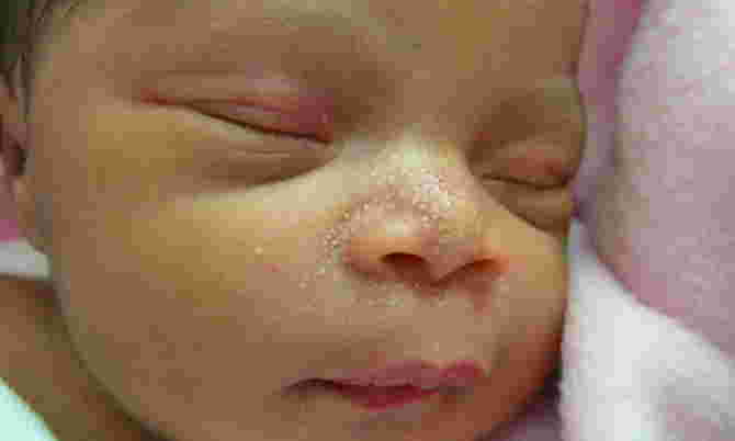 keadaan kulit bayi baru lahir, kulit bayi baru lahir, warna kulit bayi baru lahir hitam, ciri ciri bayi baru lahir akan berkulit putih, cara mengetahui warna kulit asli bayi, perubahan warna kulit bayi baru lahir, apa yang menentukan warna kulit bayi, warna kulit bayi baru lahir normal, kumpulan penyebab kulit bayi menghitam, baby kulit merah