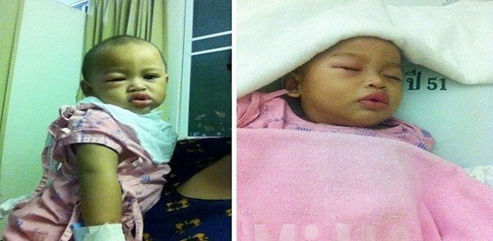 Ibu perlu baca! Jangan sembarangan bagi ubat dekat anak. Ini kesan sampingan ubat yang tak dijangka