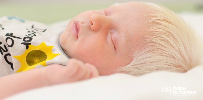 Pernahkah anda dengar tentang satu kampung Albino yang ada di Asia ini?