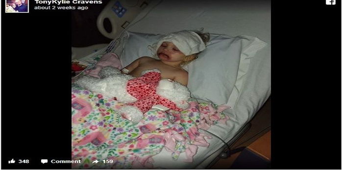 Aduh, gara-gara mencuba makeup, muka gadis kecil ini membengkak teruk! Ini peringatan untuk ibu bapa!