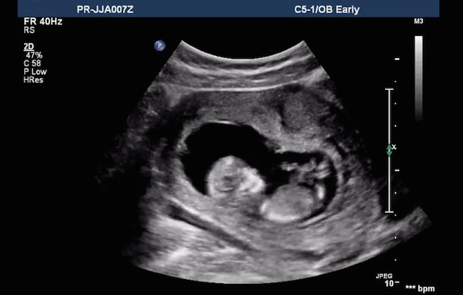 Ini sebab mengapa anda perlu tenang, senyum, dan ketawa selalu semasa hamil!