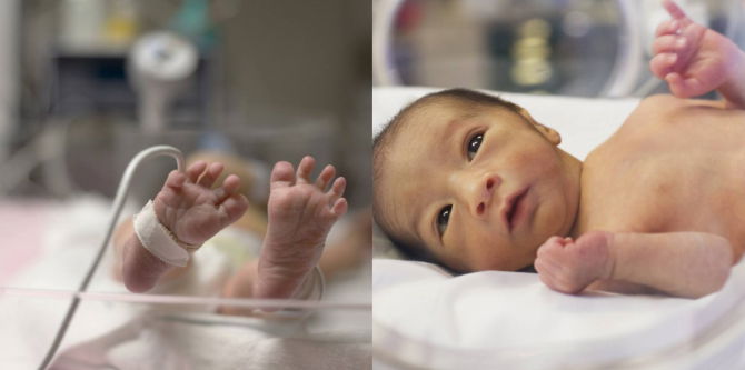 Kelahiran Pramatang: Punca & Risiko Yang Boleh Terjadi Pada Bayi, Ini Panduan Penjagaan Yang Betul