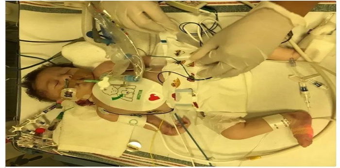 Saya rasa nak bunuh anak saya supaya dapat kurangkan sakit yang dia rasa....