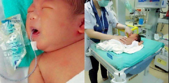 Bayi masuk ICU lepas dirawat dengan petua untuk penyakit kuning ini! Jangan suka-suka cuba petua