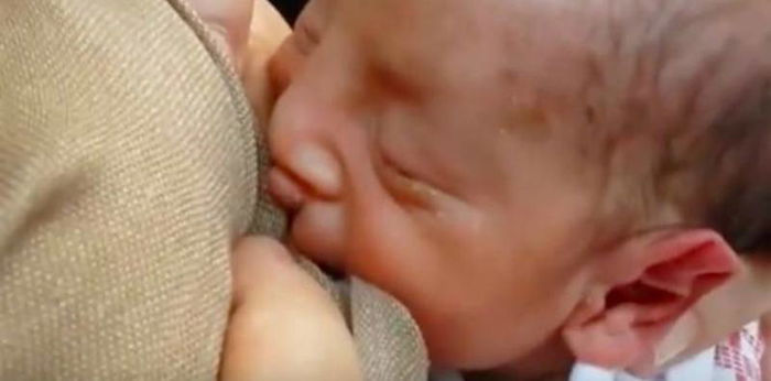 Panduan lengkap cara menyusu bayi yang sumbing (cleft lip)
