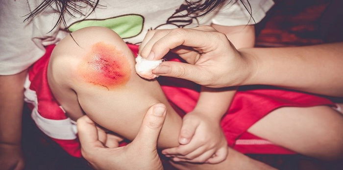 Jika anda suka bawa anak main bouncy castle, hati-hati dengan risiko tak disangka ini!