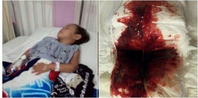 Lepas mandi di kolam renang, najis anak ini berdarah kerana jangkitan virus amoeba!