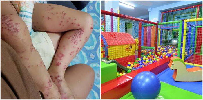 Anak dijangkiti HFMD dari taman permainan dalam mall! Kurangkan risiko dengan tips ini