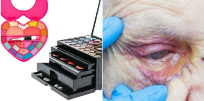 Gara-Gara Tak Pernah Check Tarikh Luput Mekap Sendiri, Wanita Ini BUTA Seumur Hidup!