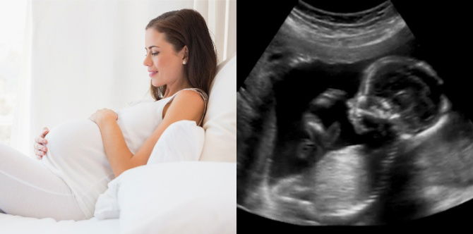 Kandungan 17 Minggu: 'Baby Kick' Makin Aktif & Janin Mula Membentuk Corak Cap Jari