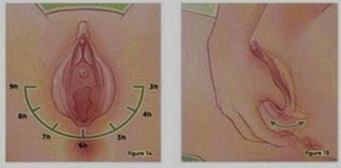 12 teknik urutan faraj bantu kurangkan koyakan semasa bersalin