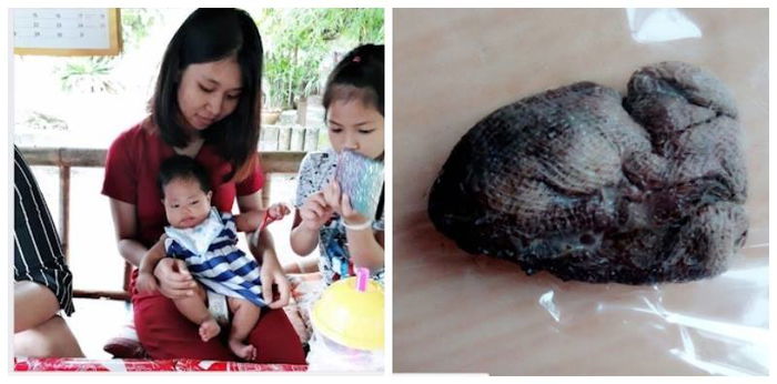 Ibu terkejut kapas ini terkeluar dari faraj lepas dua bulan bersalin!