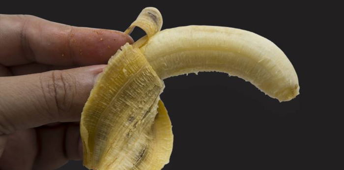 Zakar suami anda bengkok? Jaga-jaga, ia mungkin tanda penyakit ini!