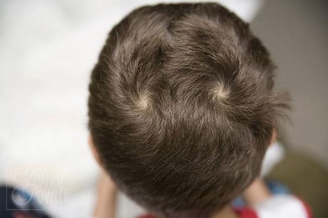 Anak Ada Dua Pusar Di Kepala Dikatakan Nakal, Keras Kepala & Suka Cari Pasal - Benarkah Kepercayaan Ini?