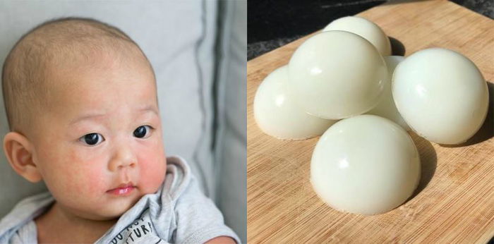 Sabun DIY ini boleh buat ekzema anak anda hilang - Jom cuba ibu!