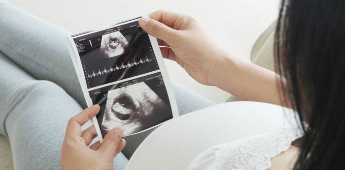 Scan Kehamilan Penting Untuk Pantau Perkembangan Janin, Bilakah Waktu Yang Sesuai?
