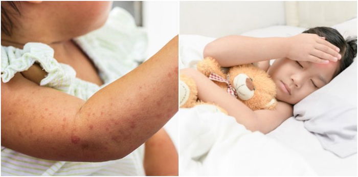 Hati-Hati Jika Anda Nak Ke Thailand Cuti Sekolah Ini, Pastikan Anak Divaksin!