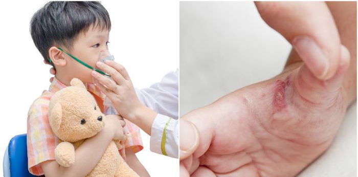 15 Cancer Signs In Children That You Shouldn't Ignore, Alert Mommies!