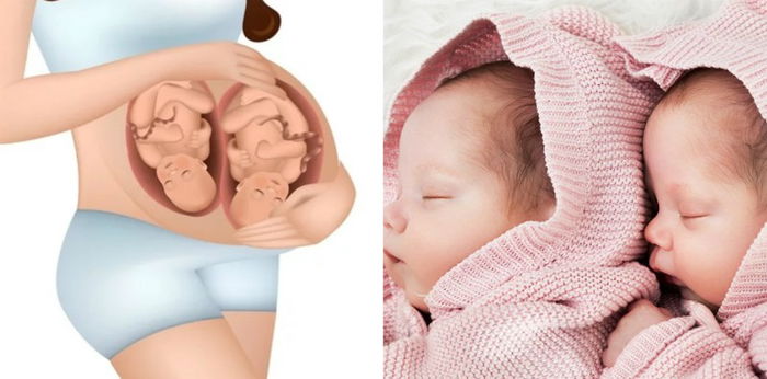 Cara Buat Anak Kembar Walaupun Tiada Genetik, 10 Tips Ini Membantu Suami Isteri