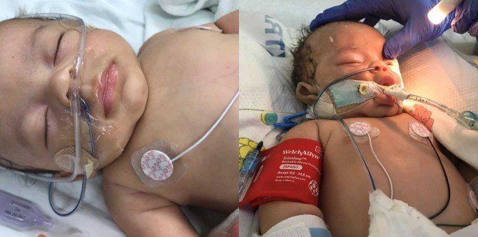 Bapa Tak Dapat Tahan Marah, Goncang Bayi Hingga Jadi Pendarahan Otak