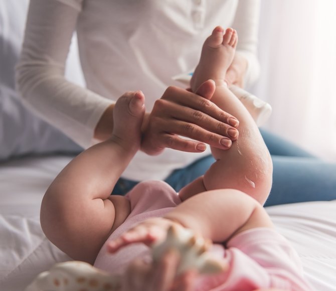 kulit bayi kering