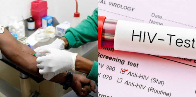 Beza HIV Dan AIDS : Ada Orang Dapat HIV Tapi Tak Dapat AIDS, Fahami Perbezaannya!
