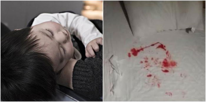 Mum horrified to see blood pouring from sleeping toddler's throat
