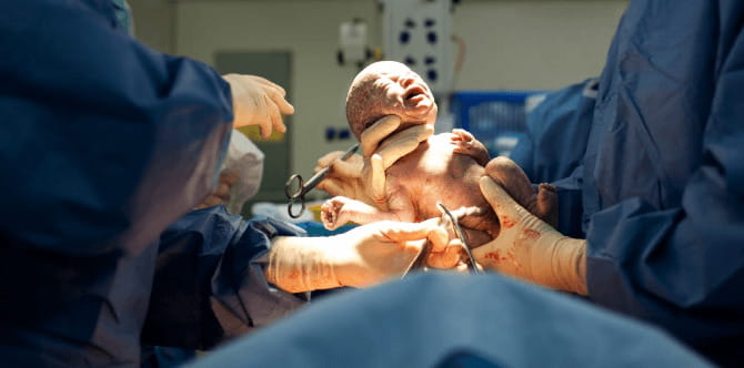 Study: Giving birth to a baby boy can be more painful than delivering a baby girl