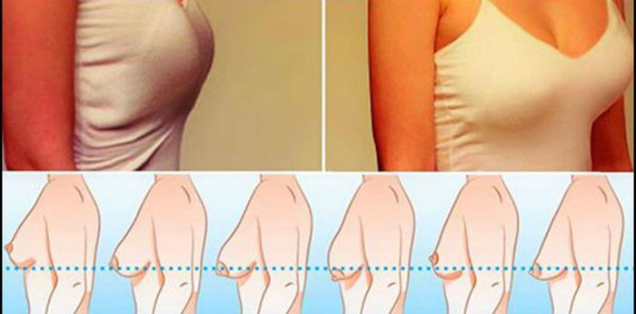 Does wearing a bra really make your breasts sag?