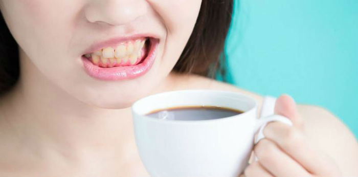 Malu Nak Senyum Bila Gigi Kuning! Apakah Penyebab Gigi Kuning Sebenarnya?