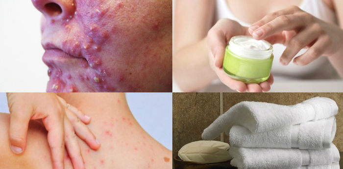5 Barang Peribadi Ini TAK BOLEH Dikongsi Dengan Orang Lain, Ia Punca Kuman Cepat Merebak!