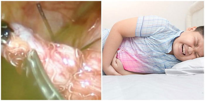 How do you know if your child has worms?