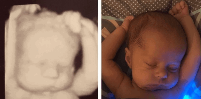 3-week-old baby sleeps exactly like he did in his mother's tummy!