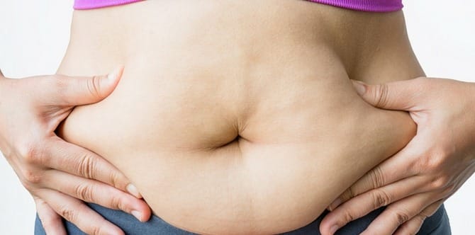 Diastasis recti: All you need to know about this postpartum condition