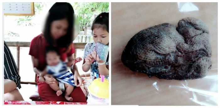 Mum horrified at gauze that emerged from uterus after natural birth