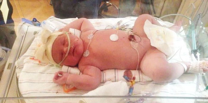 Ibu Bersalin Baby Seberat 6.8kg, Macam 'Dilanggar 2 Buah Treler'! Ini Cara Kawal Saiz Bayi Dalam Kandungan