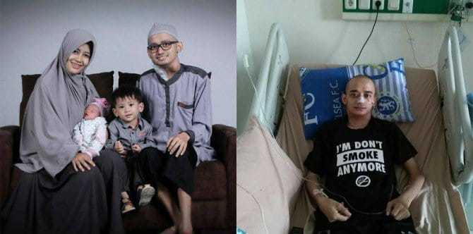 Viral 227K Share, Kisah Kedegilan Isteri Teman Suami Yang Hidap Kanser Lidah Akibat Rokok!