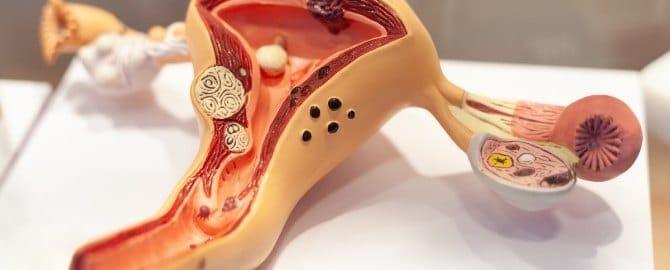 Apa Maksud 'Rahim Lemah'? Incompetent Cervix, Punca Keguguran Pada Awal Kehamilan