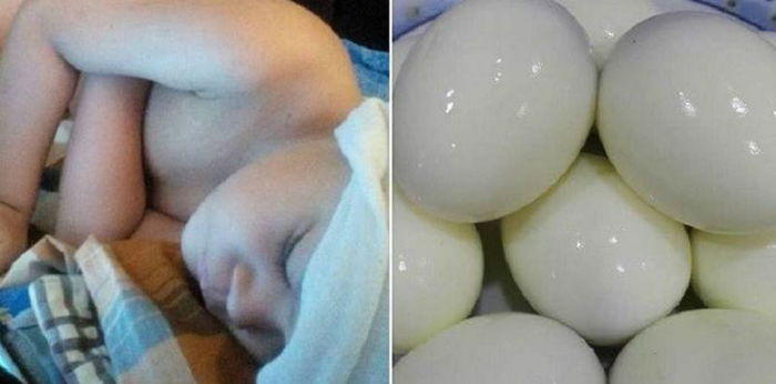 Petua Hilangkan Panas Dalam Badan Anak Dengan Telur, Boleh Cuba, Ia Sangat Berkesan!