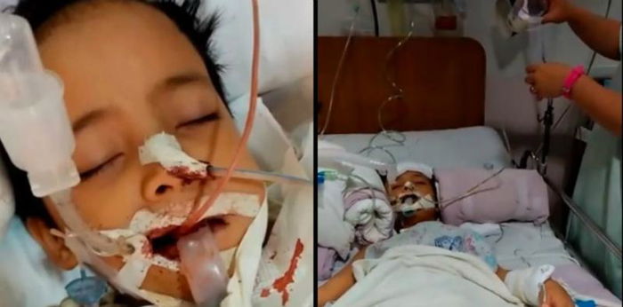 Kerana Tak GOSOK Gigi, Budak Ini Hampir Maut Bila Jangkitan Gigi Merebak Ke Otak!