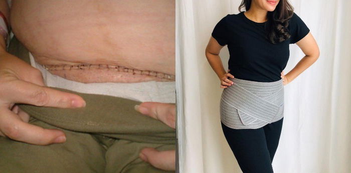 Bersalin Normal @ Czer, Ibu Perlu Pakai Bengkung! Ini 7 Manfaat Bengkung Selepas Bersalin.