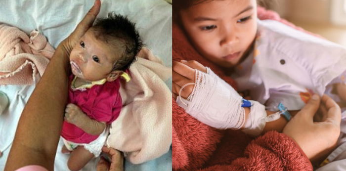 8 Gejala HIV Pada Kanak-Kanak, Orang Sekeliling Tolong Jangan Sisih Mereka!