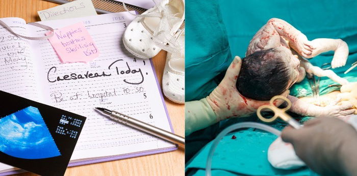 Kenapa Ada Wanita Hamil Yang Boleh Pilih Tarikh Untuk Bersalin Czer? Ini Penjelasannya