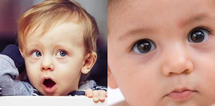 Dark Circles Pada Mata Bayi Bermaksud Ada Sesuatu Yang Tak Kena! Ibu Ayah Kena Pantau