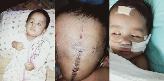 Ingatkan Normal Anak Selalu Muntah Lepas Menyusu, Rupanya Ada Penyakit Kronik Stage 4!