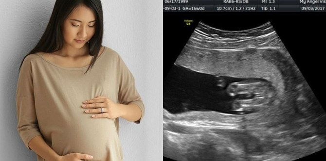 Seawal Trimester Kedua Ibu Sudah Boleh Mengesan Jantina Bayi, Take Note 5 Perkara Ini!