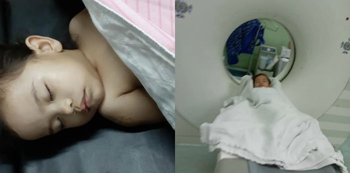 Akibat Jatuh Ketika Bermain, Anak Pengsan, Mata Terbeliak & Macam Bergerak Ikut Sesuatu!