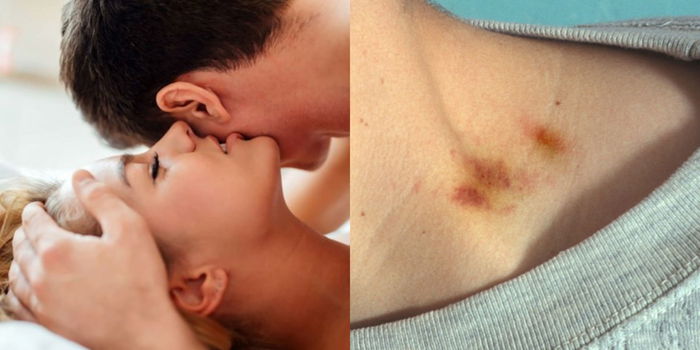 Aksi Menggigit Leher & Tubuh Pasangan, Tanda Anda Terlalu Ghairah Ketika Seks