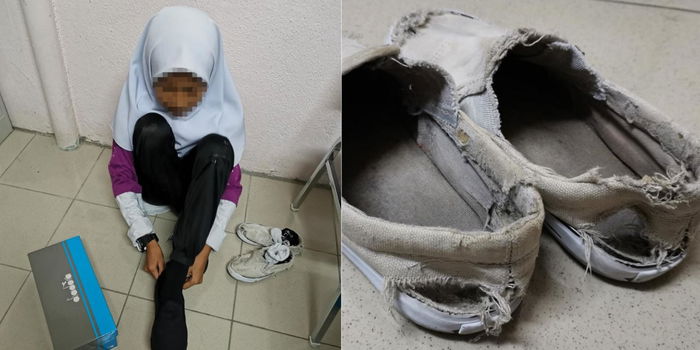 Sebak! Pelajar Ini Sanggup Pakai Kasut Koyak Rabak Dari Darjah 6 Sehingga Tingkatan 2